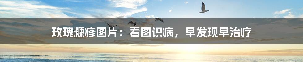 玫瑰糠疹图片：看图识病，早发现早治疗