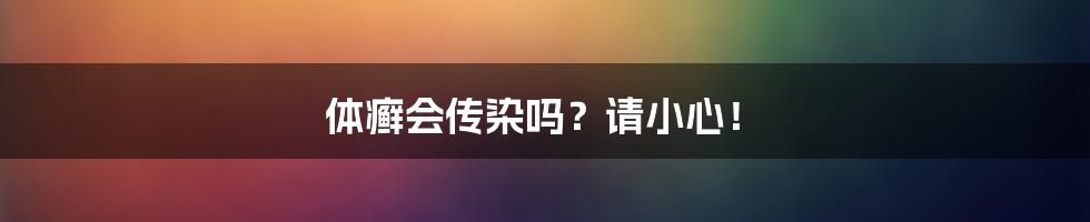 体癣会传染吗?请小心!