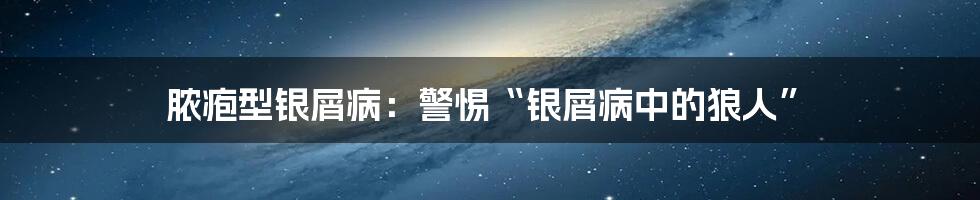 脓疱型银屑病:警惕“银屑病中的狼人”