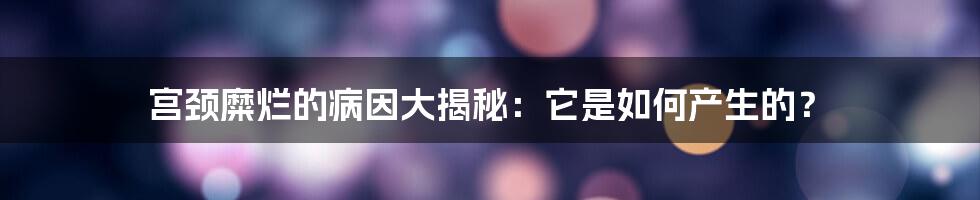 宫颈糜烂的病因大揭秘：它是如何产生的？