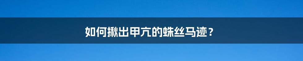 如何揪出甲亢的蛛丝马迹？