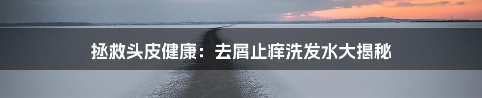拯救头皮健康:去屑止痒洗发水大揭秘