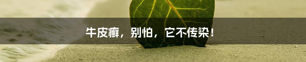 牛皮癣,别怕,它不传染!