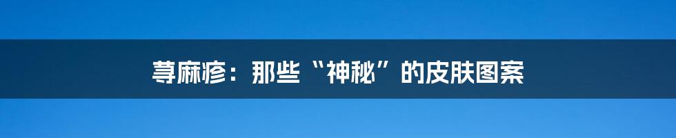 荨麻疹:那些“神秘”的皮肤图案