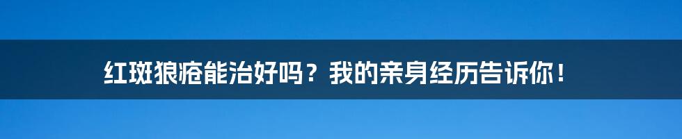 红斑狼疮能治好吗?我的亲身经历告诉你!