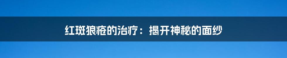 红斑狼疮的治疗:揭开神秘的面纱