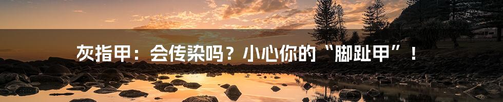灰指甲:会传染吗?小心你的“脚趾甲”!