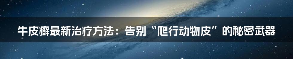 牛皮癣最新治疗方法：告别“爬行动物皮”的秘密武器