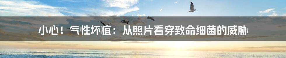 小心！气性坏疽：从照片看穿致命细菌的威胁