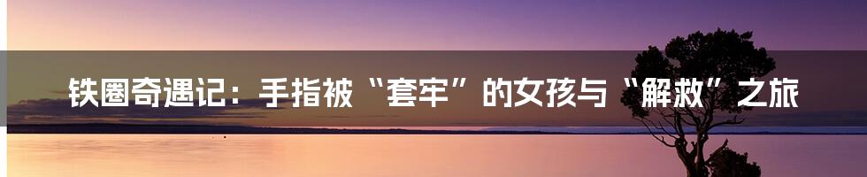 铁圈奇遇记:手指被“套牢”的女孩与“解救”之旅
