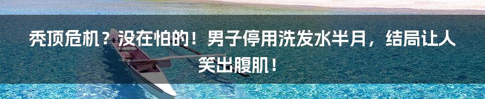秃顶危机？没在怕的！男子停用洗发水半月，结局让人笑出腹肌！