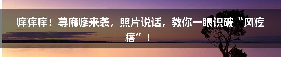 痒痒痒！荨麻疹来袭，照片说话，教你一眼识破“风疙瘩”！